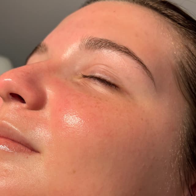Dermaplane Membership at Naturally Esthetics in Myrtle Beach, SC