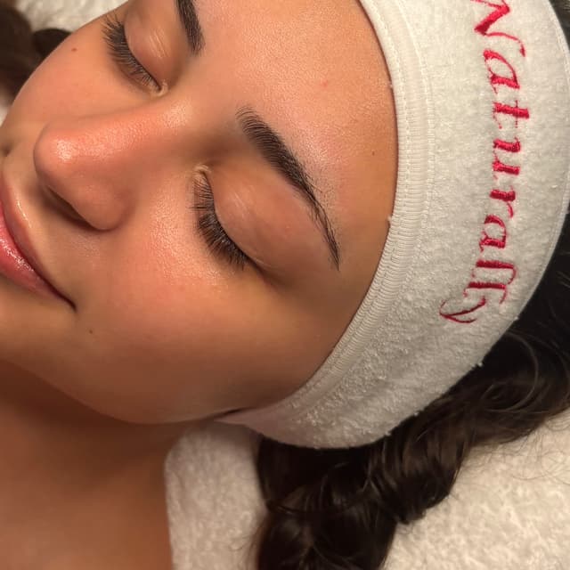 Microneedling Package at Naturally Esthetics in Myrtle Beach, SC